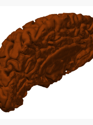 Gerçek Ölçekli İnsan Beyni Anatomik Model